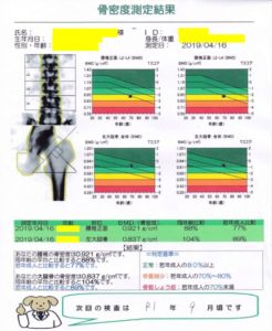 石灰沈着性腱板炎 肩の痛み 原因 骨密度